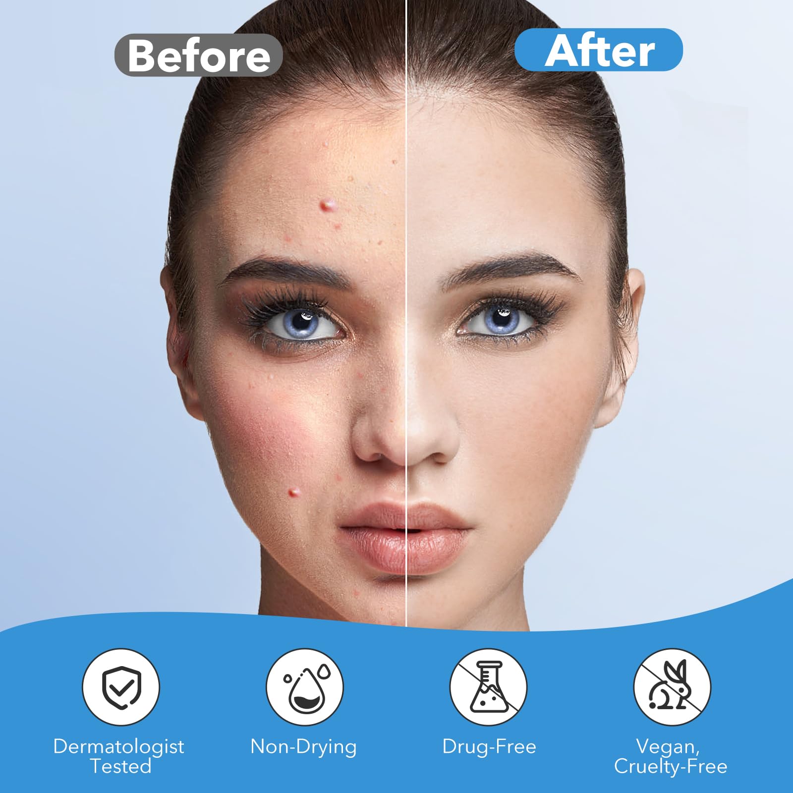 QUSTERE Pimple Patches for Face, Acne Patches Hydrocolloid, Cute Star Zit Covers for Face, Spot Stickers with Tea Tree, Salicylic Acid & Cica Oil| Round,Star,Peach Shapes| 5 Sizes| 282 Count